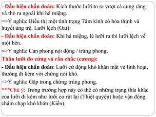 - Dấu hiệu chẩn đoán: Kích thước lưỡi to ra vượt cả cung răng
và thò ra ngoài khi há miệng.
=>Ý nghĩa: Biểu thị một tình trạng Tâm kinh có hỏa thịnh và
huyết ủng trệ. Lưỡi lệch (Oai):
- Dấu hiệu chẩn đoán: Khi há miệng, lè lưỡi ra thì lưỡi lệch về
một bên.
=>Ý nghĩa: Can phong nội động / trúng phong.
Thân lưỡi đơ cứng và rắn chắc (cương):
- Dấu hiệu chẩn đoán: Lưỡi cử động khó khăn mất vẻ linh hoạt,
thưòng đi kèm với chứng nói khó.
=>Ý nghĩa: Gặp trong chứng trúng phong.
***Chú ý: Trong trường hợp này có thể có những trạng thái khác
của lưỡi đi kèm như lưỡi co rút lại (Thiệt quyện) hoặc vận động
chậm chạp khó khăn (Kiển).
 