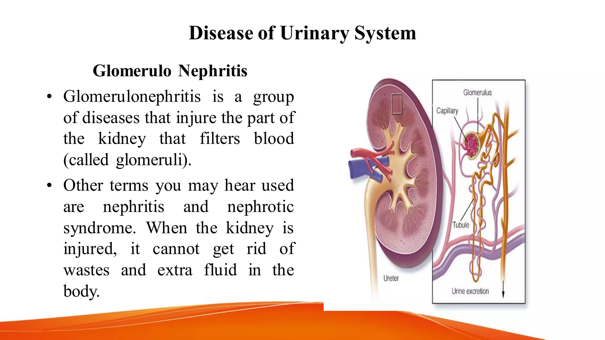 Disease of Urinary System
Glomerulo Nephritis
• Glomerulonephritis is a group
of diseases that injure the part of
the kidney that filters blood
(called glomeruli).
• Other terms you may hear used
are nephritis and nephrotic
syndrome. When the kidney is
injured, it cannot get rid of
wastes and extra fluid in the
body.
 