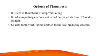 Oedema of Thrombosis
• It is seen in thrombosis of deep veins of leg.
• It is due to prolong confinement to bed due to which flow of blood is
sluggish.
• So clots form which further obstruct blood flow producing oedema.
 