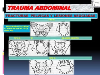 FRACTURAS PELVICAS Y LESIONES ASOCIADAS
 MECANISMO DE LESION:
CLASIFICACIÓN DE TILES
(1988 AO)
TRAUMA ABDOMINAL
TIPO B: B1 B2 (LIBRO ABIERTO)
TIPO C:
TIPO A:
 