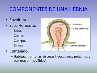 COMPONENTES DE UNA HERNIA
• Envoltura
• Saco Herniario:
– Boca.
– Cuello.
– Cuerpo.
– Fondo.
• Contenido.
– Habitualmente las vísceras huecas más próximas y
con mayor movilidad.
 