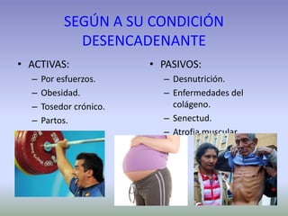 SEGÚN A SU CONDICIÓN
DESENCADENANTE
• ACTIVAS:
– Por esfuerzos.
– Obesidad.
– Tosedor crónico.
– Partos.
• PASIVOS:
– Desnutrición.
– Enfermedades del
colágeno.
– Senectud.
– Atrofia muscular.
 