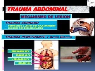 TRAUMA ABDOMINAL
MECANISMO DE LESION
 TRAUMA CERRADO
o COMPRESION O LESION POR APLASTAMIENTO
o LESIONES POR DESACELERACION
 TRAUMA PENETRANTE x Arma Blanca
HIGADO 40 %
I. DELGADO 30 %
DIAFRAGMA 29%
COLON 15%
 