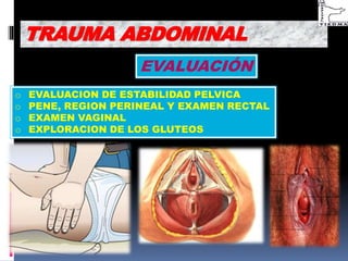 EVALUACIÓN
o EVALUACION DE ESTABILIDAD PELVICA
o PENE, REGION PERINEAL Y EXAMEN RECTAL
o EXAMEN VAGINAL
o EXPLORACION DE LOS GLUTEOS
TRAUMA ABDOMINAL
 