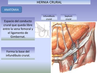 HERNIA CRURAL
ANATOMIA
Infundíbulo
crural
Espacio del conducto
crural que queda libre
entre la vena femoral y
el ligamento de
Gimbernat.
Forma la base del
infundíbulo crural.
Septum
crural
 