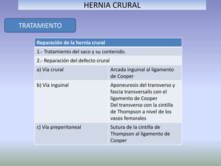 TRATAMIENTO
HERNIA CRURAL
Reparación de la hernia crural
1.- Tratamiento del saco y su contenido.
2.- Reparación del defecto crural
a) Vía crural Arcada inguinal al ligamento
de Cooper
b) Vía inguinal Aponeurosis del transverso y
fascia transversalis con el
ligamento de Cooper
Del transverso con la cintilla
de Thompson a nivel de los
vasos femorales
c) Vía preperitoneal Sutura de la cintilla de
Thompson al ligamento de
Cooper
 