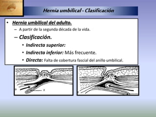 • Hernia umbilical del adulto.
– A partir de la segunda década de la vida.
– Clasificación.
• Indirecta superior:
• Indirecta inferior: Más frecuente.
• Directa: Falta de cobertura fascial del anillo umbilical.
Herniaumbilical-Clasificación
 