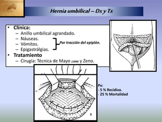 • Clínica:
– Anillo umbilical agrandado.
– Náuseas.
– Vómitos.
– Epigastrálgias.
• Tratamiento
– Cirugía: Técnica de Mayo (1898) y Zeno.
Por tracción del epiplón.
Herniaumbilical–DxyTx
Px:
- 5 % Recidiva.
- 25 % Mortalidad
 