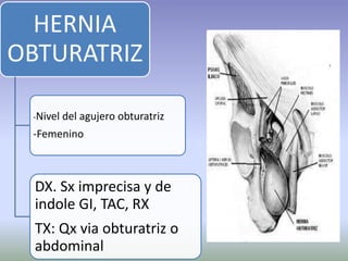 HERNIA
OBTURATRIZ
-Nivel del agujero obturatriz
-Femenino
DX. Sx imprecisa y de
indole GI, TAC, RX
TX: Qx via obturatriz o
abdominal
 
