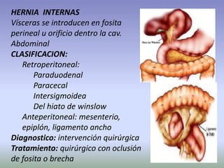 HERNIA INTERNAS
Vísceras se introducen en fosita
perineal u orificio dentro la cav.
Abdominal
CLASIFICACION:
Retroperitoneal:
Paraduodenal
Paracecal
Intersigmoidea
Del hiato de winslow
Anteperitoneal: mesenterio,
epiplón, ligamento ancho
Diagnostico: intervención quirúrgica
Tratamiento: quirúrgico con oclusión
de fosita o brecha
 
