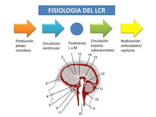 6. hidrocefalia | PPTX