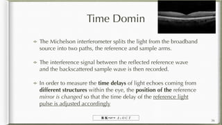 Optical Coherence Tomography (OCT) Anterior & Posterior | PDF