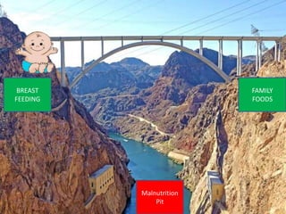 BREAST
FEEDING
FAMILY
FOODS
Malnutrition
Pit
 