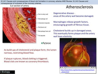 http://www.hhmi.org/biointeractive/obesity/heart
_attack.html
6.3.A1 Causes and consequences of blood clot formation in coronary arteries AND Review: 6.2.A3 Causes and
consequences of occlusion of the coronary arteries.
 