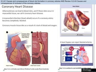 6.3.A1 Causes and consequences of blood clot formation in coronary arteries AND Review: 6.2.A3 Causes and
consequences of occlusion of the coronary arteries.
 