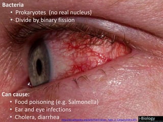 Bacteria
• Prokaryotes (no real nucleus)
• Divide by binary fission
Can cause:
• Food poisoning (e.g. Salmonella)
• Ear and eye infections
• Cholera, diarrhea http://en.wikipedia.org/wiki/File:Ericson_Type_II_Conjunctivitis.JPG
 