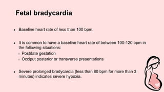 Fetal bradycardia
● Baseline heart rate of less than 100 bpm.
● It is common to have a baseline heart rate of between 100-120 bpm in
the following situations:
○ Postdate gestation
○ Occiput posterior or transverse presentations
● Severe prolonged bradycardia (less than 80 bpm for more than 3
minutes) indicates severe hypoxia.
 