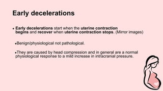 Early decelerations
● Early decelerations start when the uterine contraction
begins and recover when uterine contraction stops. (Mirror images)
●Benign/physiological not pathological.
●They are caused by head compression and in general are a normal
physiological response to a mild increase in intracranial pressure.
 