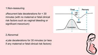 1.Non-reassuring
●Recurrent late decelerations for < 30
minutes (with no maternal or fetal clinical
risk factors such as vaginal bleeding or
significant meconium)
2.Abnormal
●Late decelerations for 30 minutes (or less
if any maternal or fetal clinical risk factors)
 
