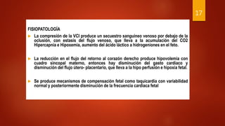 FISIOPATOLOGÍA
 La compresión de la VCI produce un secuestro sanguíneo venoso por debajo de la
oclusión, con estasis del flujo venoso, que lleva a la acumulación del CO2
Hipercapnia e Hipoxemia, aumento del ácido láctico a hidrogeniones en el feto.
 La reducción en el flujo del retorno al corazón derecho produce hipovolemia con
cuadro sincopal materno, entonces hay disminución del gasto cardiaco y
disminución del flujo útero- placentario, que lleva a la hipo perfusión e hipoxia fetal.
 Se produce mecanismos de compensación fetal como taquicardia con variabilidad
normal y posteriormente disminución de la frecuencia cardiaca fetal
17
 