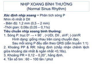 Xác định nhịp xoang = Phân tích sóng P
Nhìn rõ nhất ở DII
- Biên độ: 1,2 mm (0,5 – 2 mm)
-Thời gian: 0,08s (0,05 – 0,11s)
Tiêu chuẩn nhịp xoang bình thường:
1. Sóng P: trục 0o → + 90° , (+)/DI, DII , aVF; (-)/aVR
Hình dạng: giống nhau trên cùng chuyển đạo.
Sau mỗi sóng P đều dẫn theo QRS (dẫn truyền 1:1)
2. Khoảng PP & RR: hằng định (chấp nhận chênh lệch
giữa khoảng dài nhất & ngắn nhất <0,16s).
3. Khoảng PR = 0,12 – 0,20’’, hằng định.
4. Tần số tim : 60 – 100 lần / phút
NHỊP XOANG BÌNH THƯỜNG
(Normal Sinus Rhythm)
 