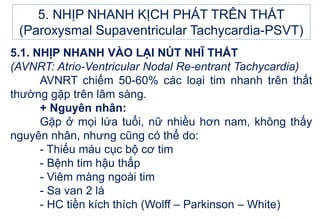 5.1. NHỊP NHANH VÀO LẠI NÚT NHĨ THẤT
(AVNRT: Atrio-Ventricular Nodal Re-entrant Tachycardia)
AVNRT chiếm 50-60% các loại tim nhanh trên thất
thường gặp trên lâm sàng.
+ Nguyên nhân:
Gặp ở mọi lứa tuổi, nữ nhiều hơn nam, không thấy
nguyên nhân, nhưng cũng có thể do:
- Thiếu máu cục bộ cơ tim
- Bệnh tim hậu thấp
- Viêm màng ngoài tim
- Sa van 2 lá
- HC tiền kích thích (Wolff – Parkinson – White)
5. NHỊP NHANH KỊCH PHÁT TRÊN THẤT
(Paroxysmal Supaventricular Tachycardia-PSVT)
 