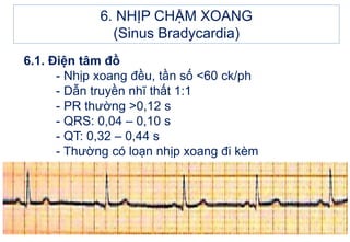 6.1. Điện tâm đồ
- Nhịp xoang đều, tần số <60 ck/ph
- Dẫn truyền nhĩ thất 1:1
- PR thường >0,12 s
- QRS: 0,04 – 0,10 s
- QT: 0,32 – 0,44 s
- Thường có loạn nhịp xoang đi kèm
6. NHỊP CHẬM XOANG
(Sinus Bradycardia)
 
