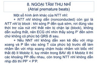 Một số hình ảnh khác của NTT nhĩ:
+ NTT nhĩ không dẫn (nonconducted) còn gọi là
NTT nhĩ bị block : khi sóng P đến quá sớm, rơi đúng vào
thời trơ của nút nhĩ thất nên bị chặn lại (block), không
dẫn xuống thất, nên ECG chỉ nhìn thấy sóng P’ đến sớm
chứ không có phức bộ QRS đi sau.
+ Nếu NNT nhĩ không dẫn xen kẽ đều với nhịp
xoang và P lẫn vào sóng T của phức bộ trước dễ làm
nhầm lẫn với nhịp xoang chậm hoặc nhầm với blốc nhĩ
thất độ II Mobitz II, tuy nhiên trong BAV độ II Mobitz II thì
các khoảng PP đều nhau, còn trong NTT nhĩ không dẫn
nhịp đôi thì PP’ < P’P.
8. NGOẠI TÂM THU NHĨ
(Atrial premature beats)
 