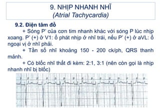 9.2. Điện tâm đồ
+ Sóng P’ của cơn tim nhanh khác với sóng P lúc nhịp
xoang. P’ (+) ở V1: ổ phát nhịp ở nhĩ trái, nếu P’ (+) ở aVL: ổ
ngoại vị ở nhĩ phải.
+ Tần số nhĩ khoảng 150 - 200 ck/ph, QRS thanh
mảnh.
+ Có blốc nhĩ thất đi kèm: 2:1, 3:1 (nên còn gọi là nhịp
nhanh nhĩ bị blốc)
9. NHỊP NHANH NHĨ
(Atrial Tachycardia)
 