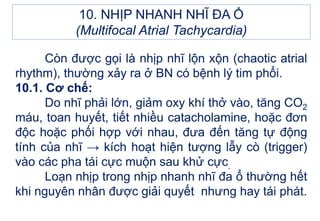 Còn được gọi là nhịp nhĩ lộn xộn (chaotic atrial
rhythm), thường xảy ra ở BN có bệnh lý tim phổi.
10.1. Cơ chế:
Do nhĩ phải lớn, giảm oxy khí thở vào, tăng CO2
máu, toan huyết, tiết nhiều catacholamine, hoặc đơn
độc hoặc phối hợp với nhau, đưa đến tăng tự động
tính của nhĩ → kích hoạt hiện tượng lẫy cò (trigger)
vào các pha tái cực muộn sau khử cực.
Loạn nhịp trong nhịp nhanh nhĩ đa ổ thường hết
khi nguyên nhân được giải quyết nhưng hay tái phát.
10. NHỊP NHANH NHĨ ĐA Ổ
(Multifocal Atrial Tachycardia)
 