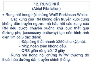 + Rung nhĩ trong hội chứng Wolff-Parkinson-White:
Các xung của RN không dẫn truyền xuôi cũng
không dẫn truyền ngược mà hầu hết các xung của
RN đều được chuyển xuống khử cực thất qua
đường phụ (assessory pathway) tạo nên hình ảnh
điện tim có 3 đặc điểm:
- Đáp ứng thất nhanh ≥250 chu kỳ/phút.
- Nhịp hoàn toàn không đều.
- QRS giãn rộng ≥0,12 giây
Rung nhĩ trong hội chứng WPW thường do
thoái hóa đường dẫn truyền chính thống.
12. RUNG NHĨ
(Atrial Fibrilation)
 