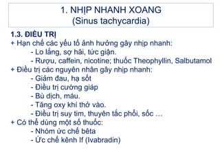 1.3. ĐIỀU TRỊ
+ Hạn chế các yếu tố ảnh hưởng gây nhịp nhanh:
- Lo lắng, sợ hãi, tức giận.
- Rượu, caffein, nicotine; thuốc Theophyllin, Salbutamol
+ Điều trị các nguyên nhân gây nhịp nhanh:
- Giảm đau, hạ sốt
- Điều trị cường giáp
- Bù dịch, máu.
- Tăng oxy khí thở vào.
- Điều trị suy tim, thuyên tắc phổi, sốc …
+ Có thể dùng một số thuốc:
- Nhóm ức chế bêta
- Ức chế kênh If (Ivabradin)
1. NHỊP NHANH XOANG
(Sinus tachycardia)
 