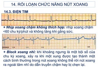 14.3. ĐiỆN TIM
+ Nhịp xoang chậm không thích hợp: nhịp xoang chậm
<60 chu kỳ/phút và không tăng khi gắng sức.
+ Block xoang nhĩ: khi khoảng ngưng là một bội số của
chu kỳ xoang, xảy ra khi một xung được tạo thành một
cách bình thường trong nút xoang không thể rời nút xoang
ra ngoài tâm nhĩ do dẫn truyền chậm hay bị chẹn lại.
14. RỐI LOẠN CHỨC NĂNG NÚT XOANG
 