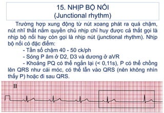 Trường hợp xung động từ nút xoang phát ra quá chậm,
nút nhĩ thất nắm quyền chủ nhịp chỉ huy được cả thất gọi là
nhịp bộ nối hay còn gọi là nhịp nút (junctional rhythm). Nhịp
bộ nối có đặc điểm:
- Tần số chậm 40 - 50 ck/ph
- Sóng P âm ở D2, D3 và dương ở aVR
- Khoảng PQ có thể ngắn lại (< 0,11s), P có thể chồng
lên QRS như cái móc, có thể lẫn vào QRS (nên không nhìn
thấy P) hoặc đi sau QRS.
15. NHỊP BỘ NỐI
(Junctional rhythm)
 