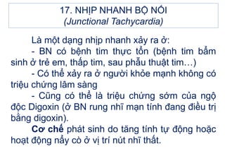Là một dạng nhịp nhanh xảy ra ở:
- BN có bệnh tim thực tổn (bệnh tim bẩm
sinh ở trẻ em, thấp tim, sau phẫu thuật tim…)
- Có thể xảy ra ở người khỏe mạnh không có
triệu chứng lâm sàng
- Cũng có thể là triệu chứng sớm của ngộ
độc Digoxin (ở BN rung nhĩ mạn tính đang điều trị
bằng digoxin).
Cơ chế phát sinh do tăng tính tự động hoặc
hoạt động nẩy cò ở vị trí nút nhĩ thất.
17. NHỊP NHANH BỘ NỐI
(Junctional Tachycardia)
 