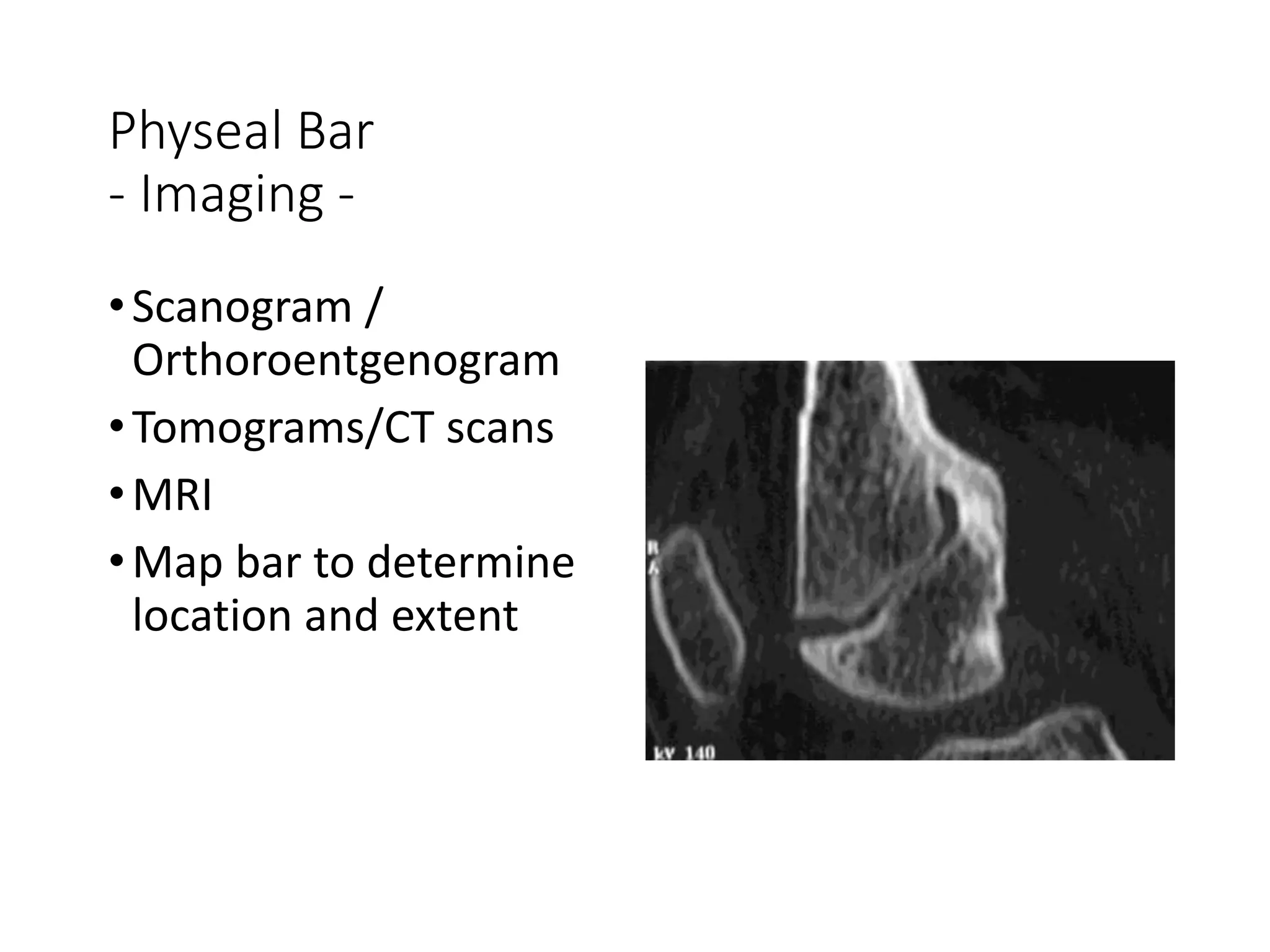 Fractures in children | PPT