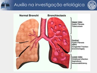 Auxílio na investigação etiológica
 