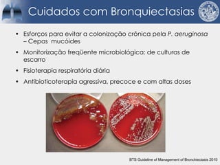 Cuidados com Bronquiectasias
• Esforços para evitar a colonização crônica pela P. aeruginosa
– Cepas mucóides
• Monitorização freqüente microbiológica: de culturas de
escarro
• Fisioterapia respiratória diária
• Antibioticoterapia agressiva, precoce e com altas doses
BTS Guideline of Management of Bronchiectasis 2010
 