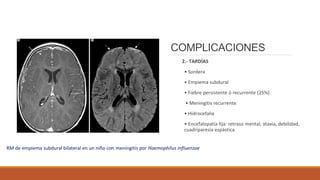 COMPLICACIONES
2.- TARDÍAS
• Sordera
• Empiema subdural
• Fiebre persistente ó recurrente (25%)
• Meningitis recurrente
• Hidrocefalia
• Encefalopatía fija: retraso mental, ataxia, debilidad,
cuadriparesia espástica
RM de empiema subdural bilateral en un niño con meningitis por Haemophilus influenzae
 