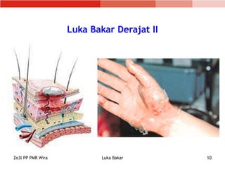 6. Luka Bakar.ppt