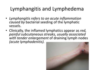 Lymphangitis and Lymphedema
• Lymphangitis refers to an acute inflammation
caused by bacterial seeding of the lymphatic
ve...