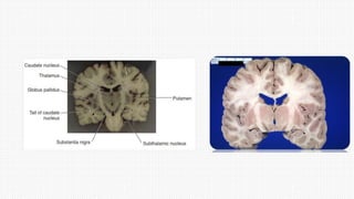 6. BASAL GANGLIA.pptx