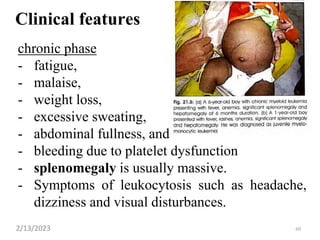 Clinical features
chronic phase
- fatigue,
- malaise,
- weight loss,
- excessive sweating,
- abdominal fullness, and
- bleeding due to platelet dysfunction
- splenomegaly is usually massive.
- Symptoms of leukocytosis such as headache,
dizziness and visual disturbances.
2/13/2023 60
 