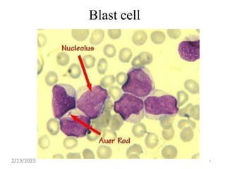 Blast cell
7
2/13/2023
 