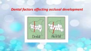 Dental factors affecting occlusal development
 