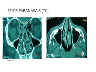 SEIOS PARANASAIS (TC)
HUWC-UFC
 