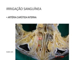 IRRIGAÇÃO SANGUÍNEA
• ARTÉRIA CARÓTIDA INTERNA
HUWC-UFC
 