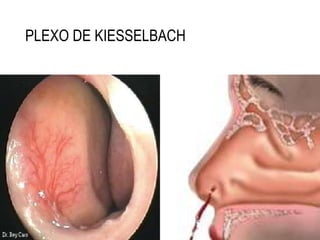 PLEXO DE KIESSELBACH
 