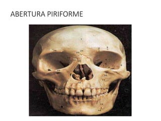 ABERTURA PIRIFORME
 