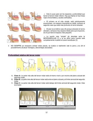 12
® Esto lo puso para ver los espacios y profundidad que
tienen el tercer molar inferior. Hay que fijarse en las líneas
rojas (horizontales) y azules (verticales).
® El primero es el más simple, está prácticamente
erupcionado, con espacio importante en distal, contrario al
segundo caso que está más profundo al nervio alveolar.
® El peor es el último caso (9) porque atravesó el nervio
alveolar y tampoco hay espacio distal para que erupcione,
es el que tiene el espacio más pequeño
® La opción más “simple” de abordaje seria la
MESIOANGULAR (1) y la as difícil seria cuando está
completamente invadido el canal mandibular (3)
• NO SIEMPRE es necesario extraer estas piezas, se evalúa si realmente vale la pena y es útil el
procedimiento (Evaluar Ventajas y desventajas asociadas)
Profundidad relativa del tercer molar
A. Clase A: La parte más alta del tercer molar está al mismo nivel o por encima del plano oclusal del
segundo molar.
B. Clase B: La parte más alta del tercer molar está entre el plano oclusal y el límite cervical del segundo
molar.
C. Clase C: La parte más alta del tercer molar está debajo del límite cervical del segundo molar. Este
es el peor.
A B C
1 3
7 9
 